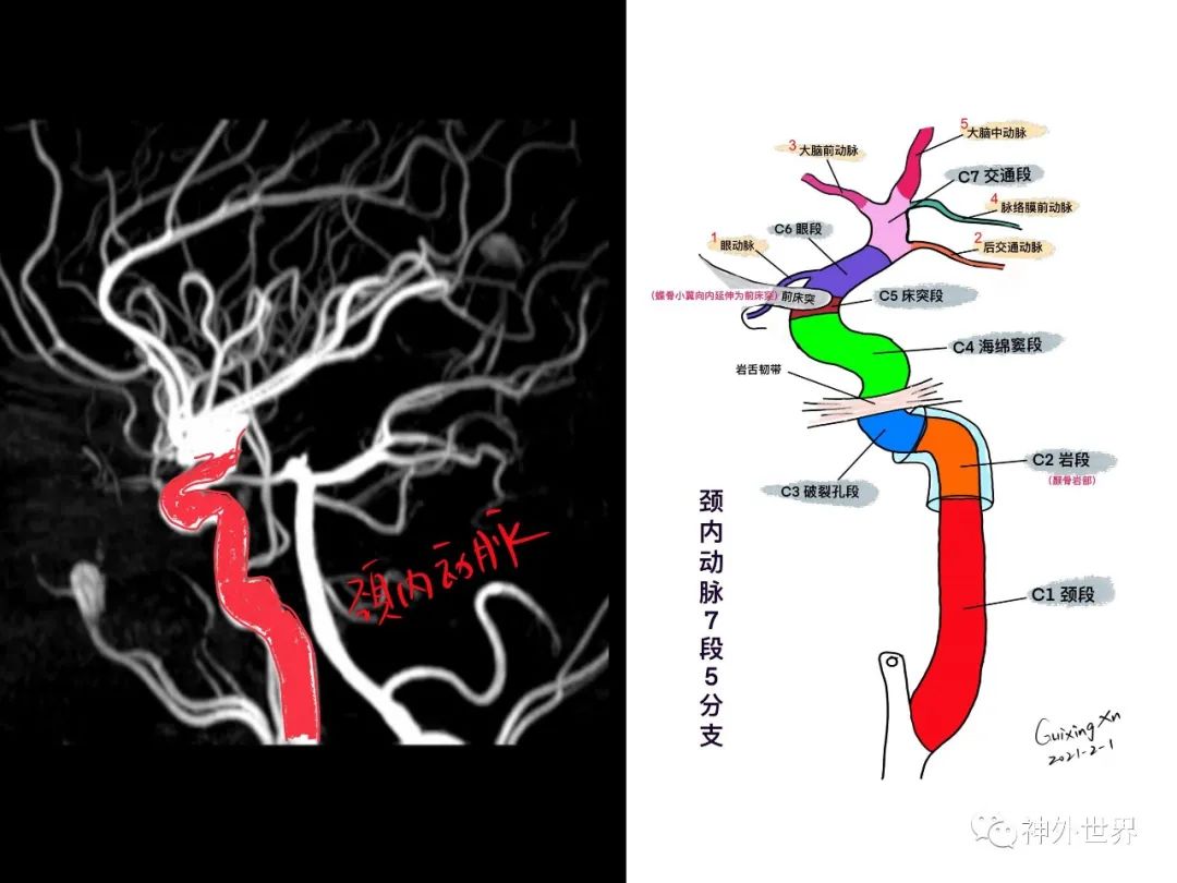 影像PPT - 【PPT】垂体瘤的多彩阅片-13