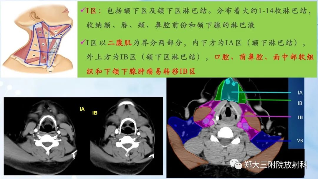 影像PPT - 【PPT】颈部淋巴结的分区及常见病变-6