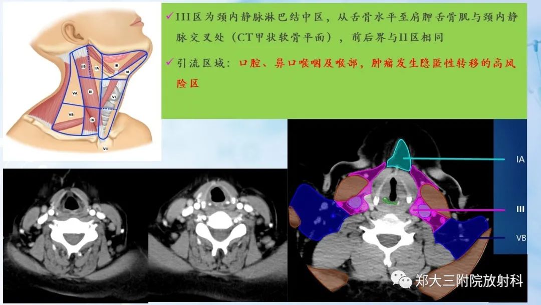 影像PPT - 【PPT】颈部淋巴结的分区及常见病变-8