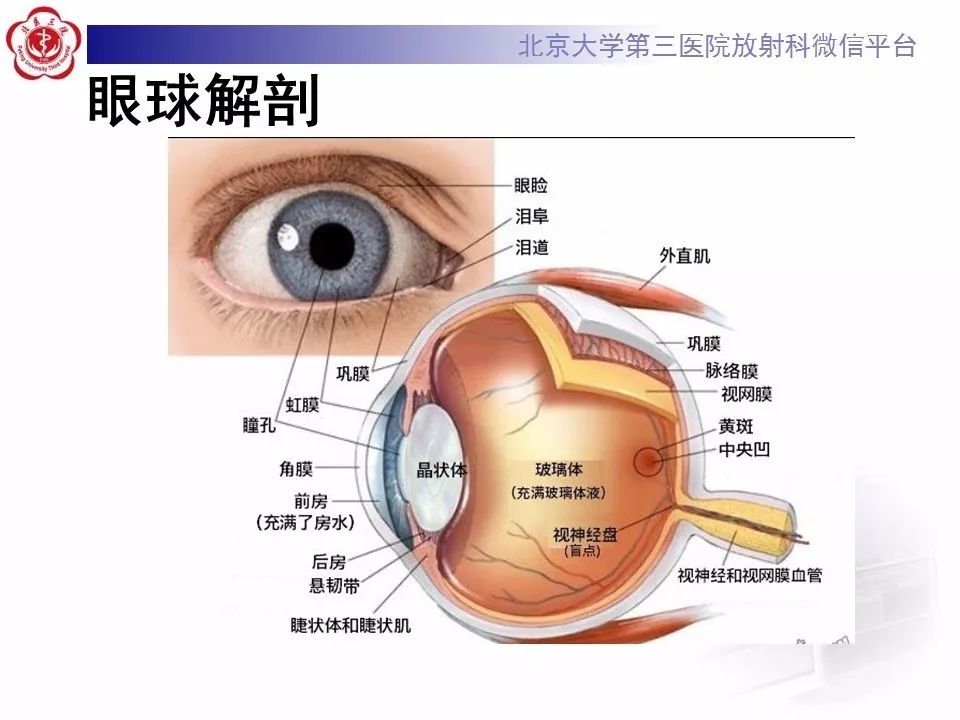 影像PPT - 【PPT】脉络膜骨瘤的影像表现-12