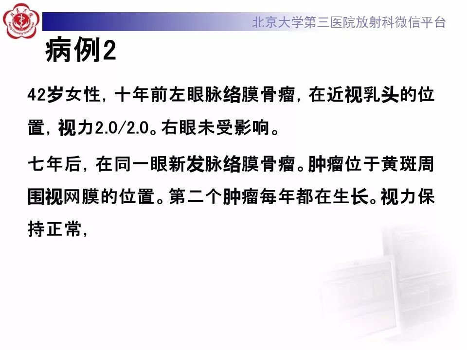 影像PPT - 【PPT】脉络膜骨瘤的影像表现-23