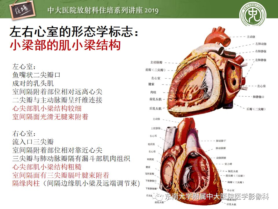 影像PPT - 【PPT】复杂先心病分段分析法简介-11