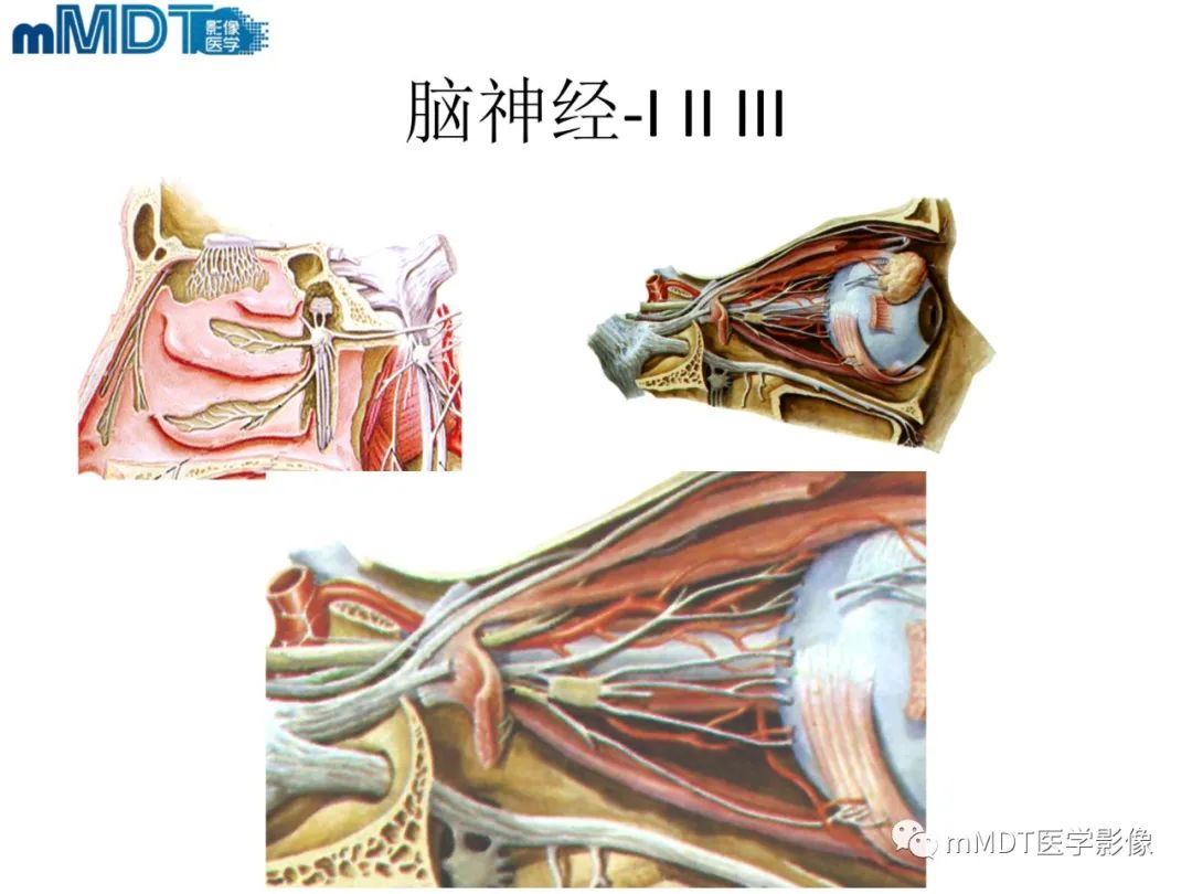 影像PPT - 【PPT】脑神经的影像辨识-6 影像PPT - 【PPT】脑神经的影像辨识-6