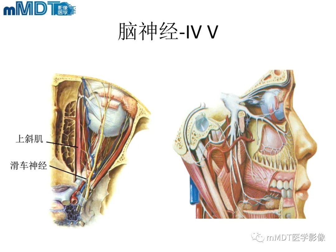 影像PPT - 【PPT】脑神经的影像辨识-7 影像PPT - 【PPT】脑神经的影像辨识-7