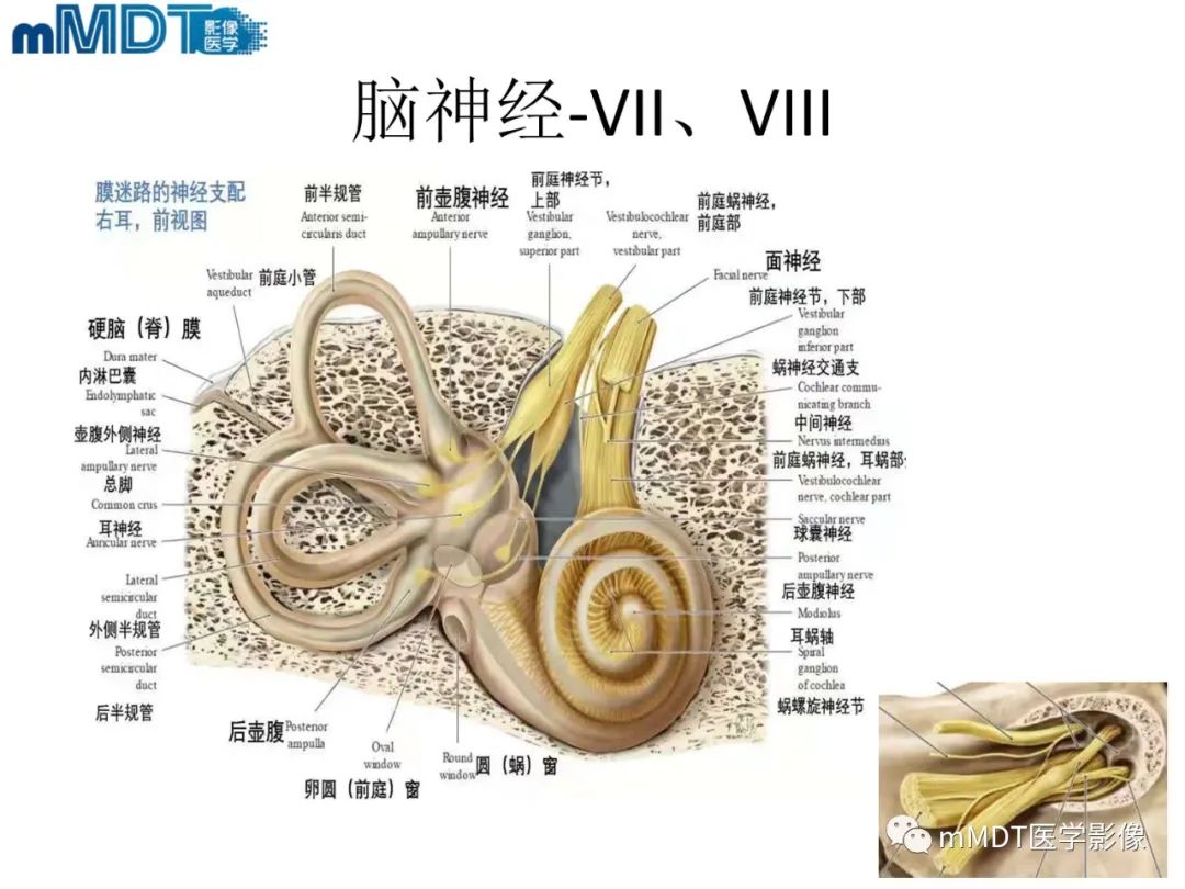 影像PPT - 【PPT】脑神经的影像辨识-10 影像PPT - 【PPT】脑神经的影像辨识-10