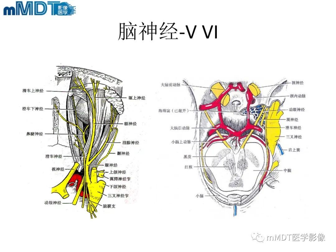 影像PPT - 【PPT】脑神经的影像辨识-8 影像PPT - 【PPT】脑神经的影像辨识-8
