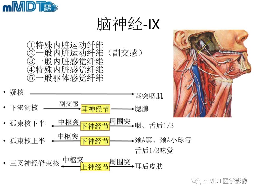 影像PPT - 【PPT】脑神经的影像辨识-12 影像PPT - 【PPT】脑神经的影像辨识-12