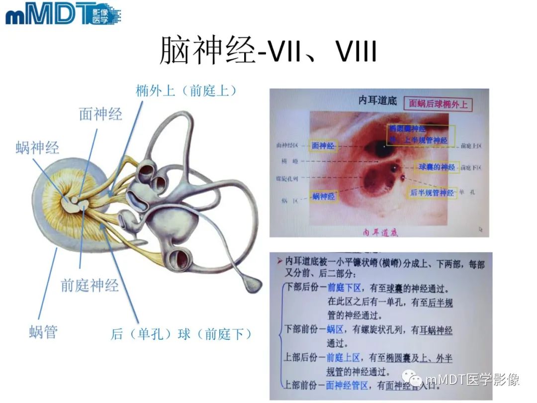 影像PPT - 【PPT】脑神经的影像辨识-11 影像PPT - 【PPT】脑神经的影像辨识-11