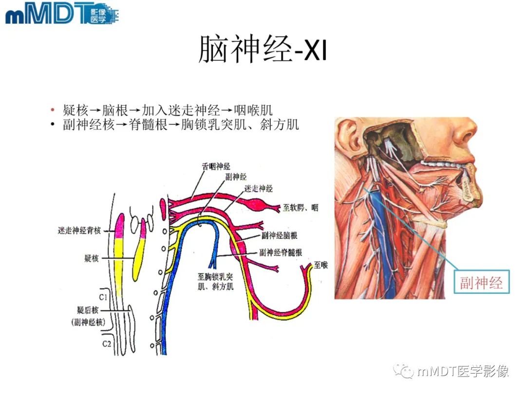 影像PPT - 【PPT】脑神经的影像辨识-14 影像PPT - 【PPT】脑神经的影像辨识-14