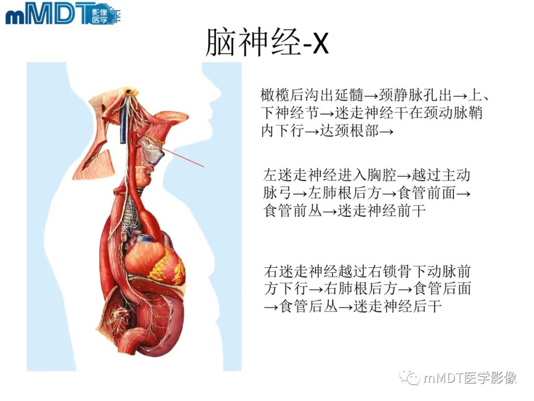 影像PPT - 【PPT】脑神经的影像辨识-13 影像PPT - 【PPT】脑神经的影像辨识-13