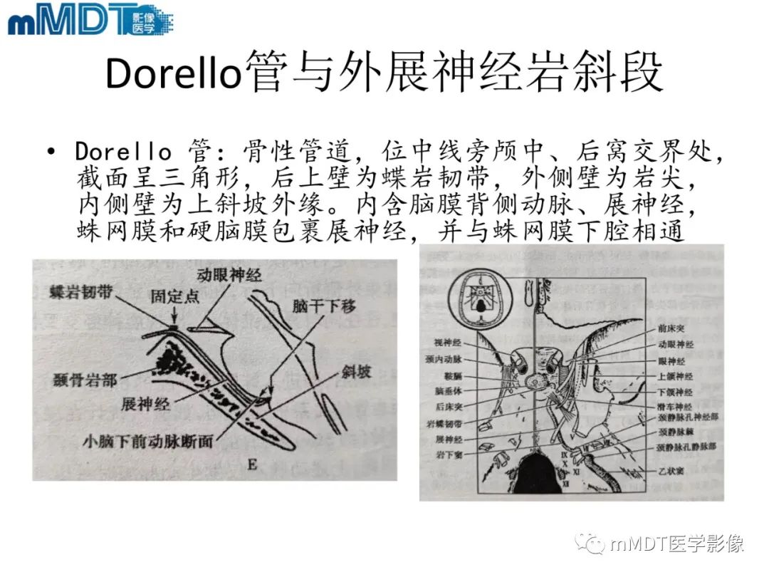 影像PPT - 【PPT】脑神经的影像辨识-46 影像PPT - 【PPT】脑神经的影像辨识-46
