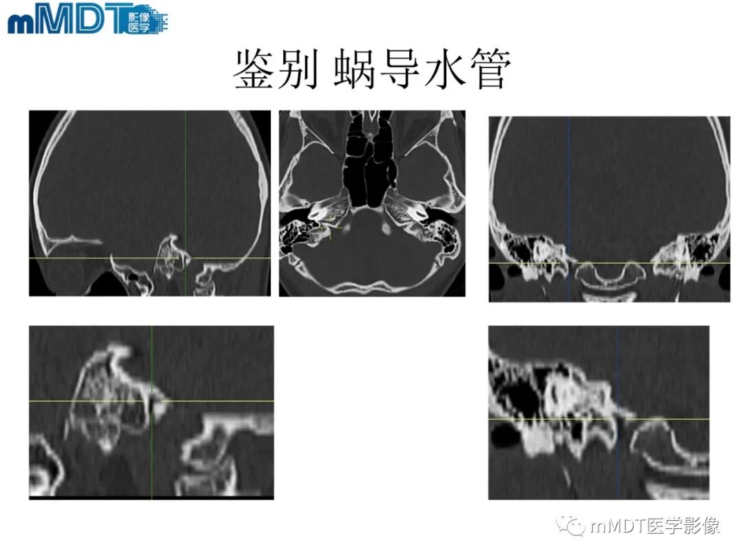 影像PPT - 【PPT】脑神经的影像辨识-60 影像PPT - 【PPT】脑神经的影像辨识-60