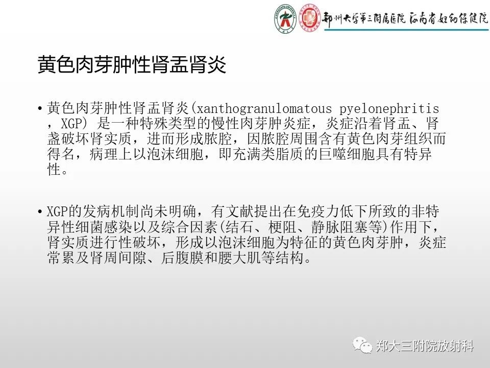 影像PPT - 【PPT】急性肾炎肾炎的影像解读-12