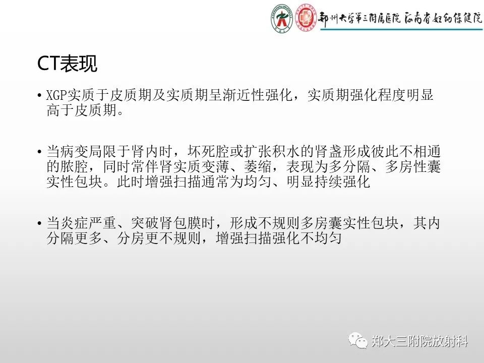 影像PPT - 【PPT】急性肾炎肾炎的影像解读-14