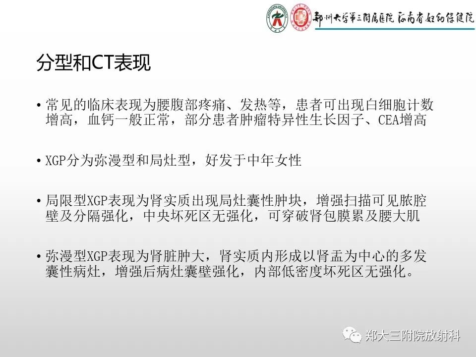 影像PPT - 【PPT】急性肾炎肾炎的影像解读-13