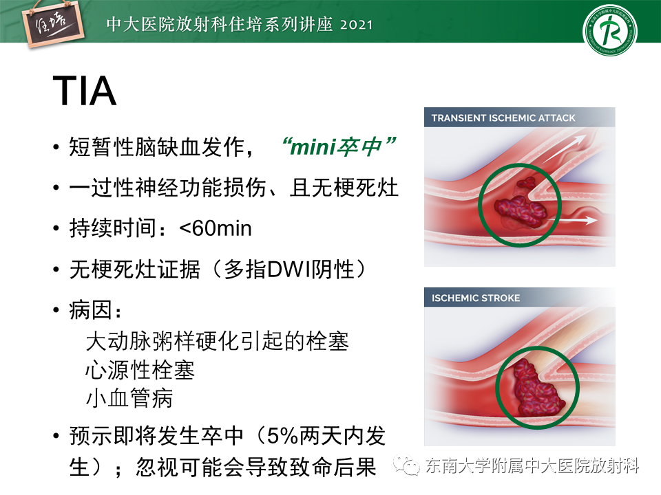 影像PPT - 【PPT】缺血性脑血管病的追根溯源-3
