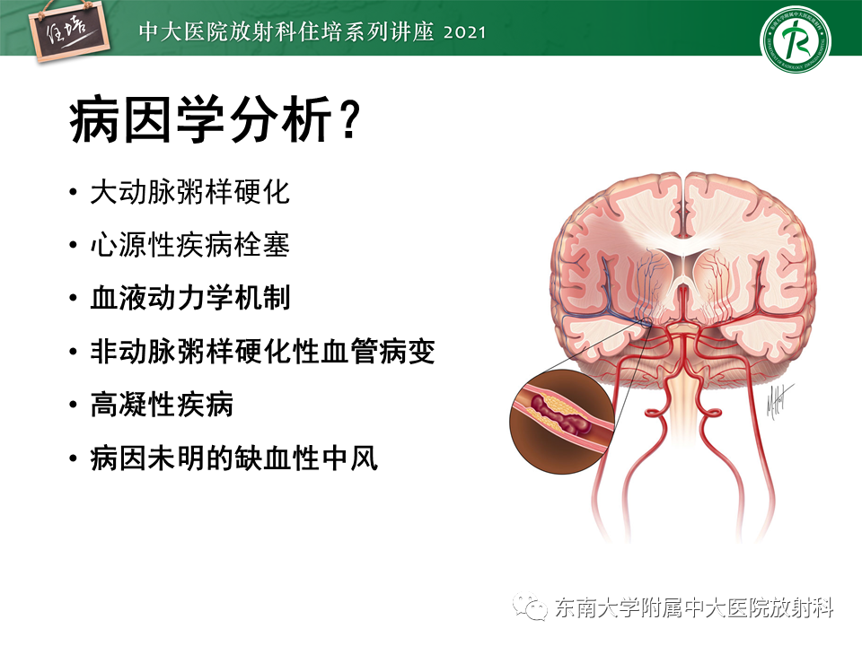 影像PPT - 【PPT】缺血性脑血管病的追根溯源-6
