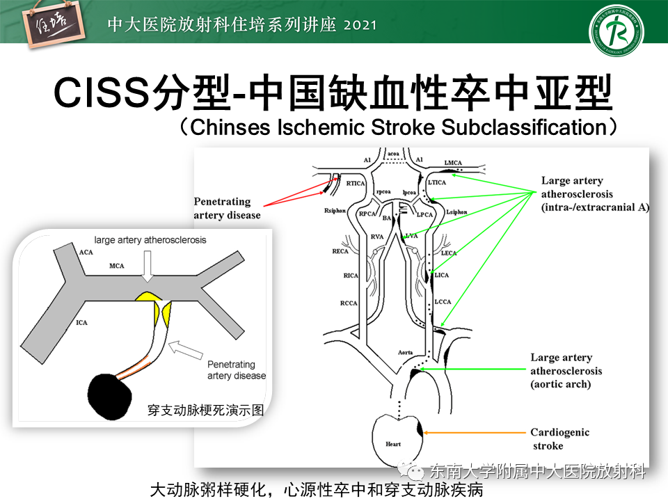 影像PPT - 【PPT】缺血性脑血管病的追根溯源-13