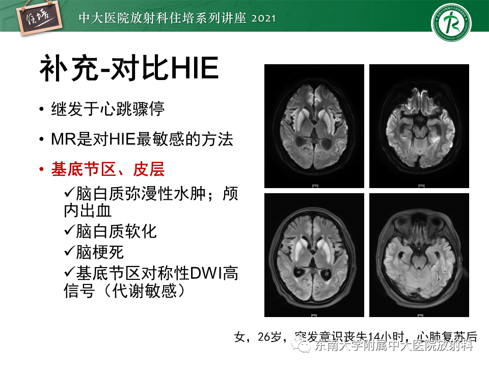 影像PPT - 【PPT】缺血性脑血管病的追根溯源-19