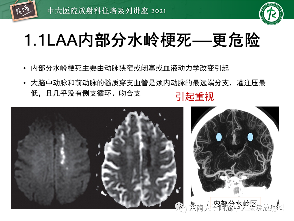 影像PPT - 【PPT】缺血性脑血管病的追根溯源-18