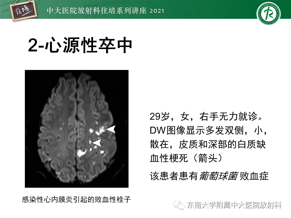 影像PPT - 【PPT】缺血性脑血管病的追根溯源-24