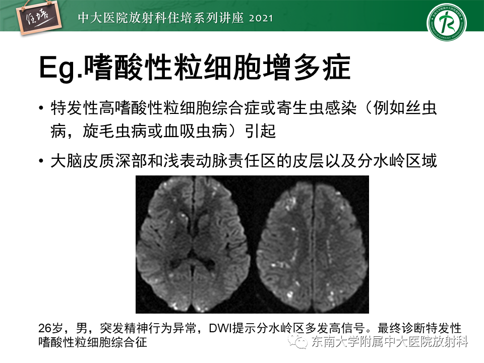 影像PPT - 【PPT】缺血性脑血管病的追根溯源-30