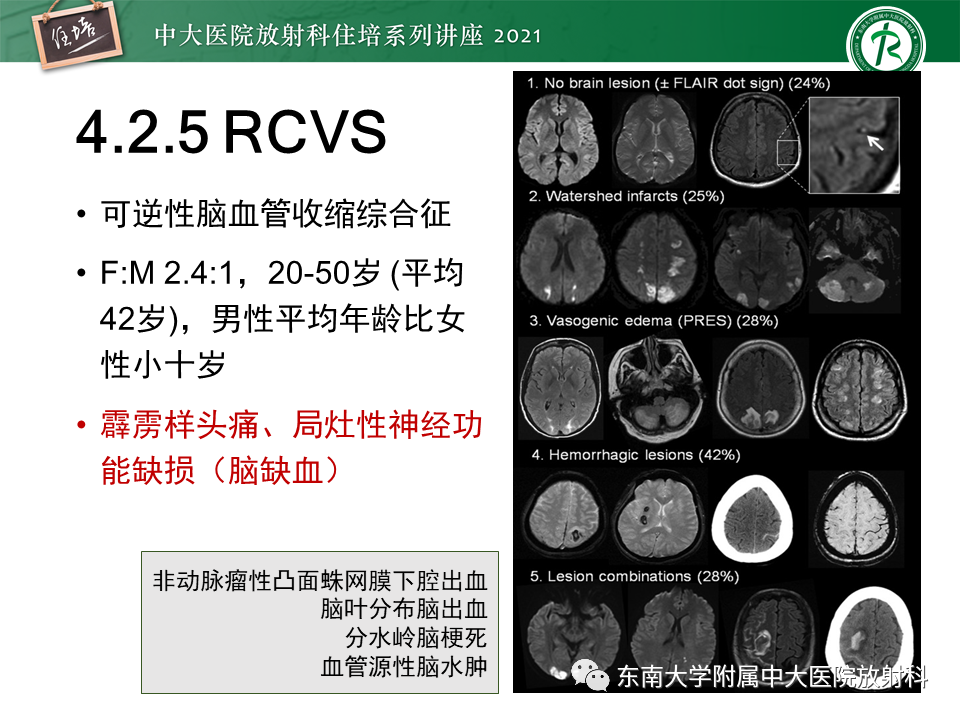 影像PPT - 【PPT】缺血性脑血管病的追根溯源-38