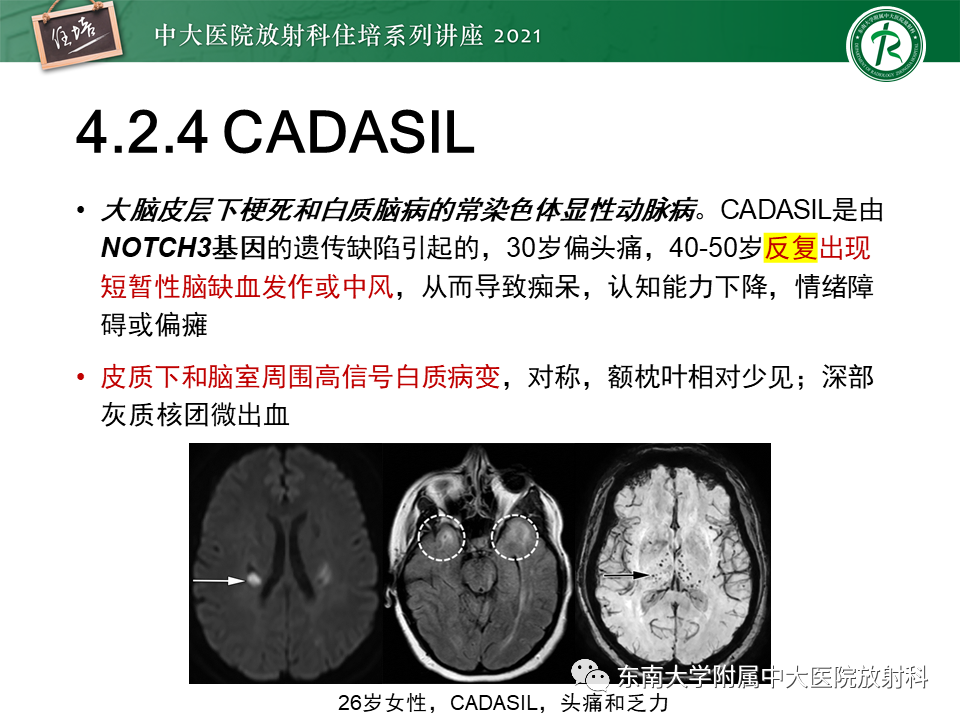 影像PPT - 【PPT】缺血性脑血管病的追根溯源-37