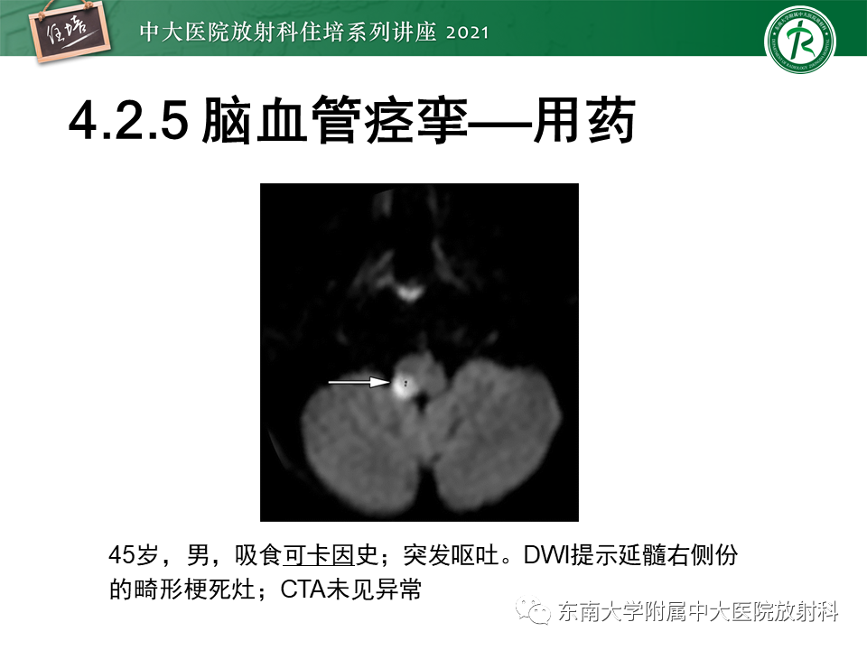 影像PPT - 【PPT】缺血性脑血管病的追根溯源-39