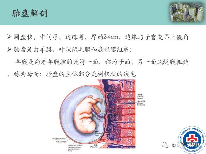 影像PPT - 【PPT】胎盘植入疾病MR评估-5