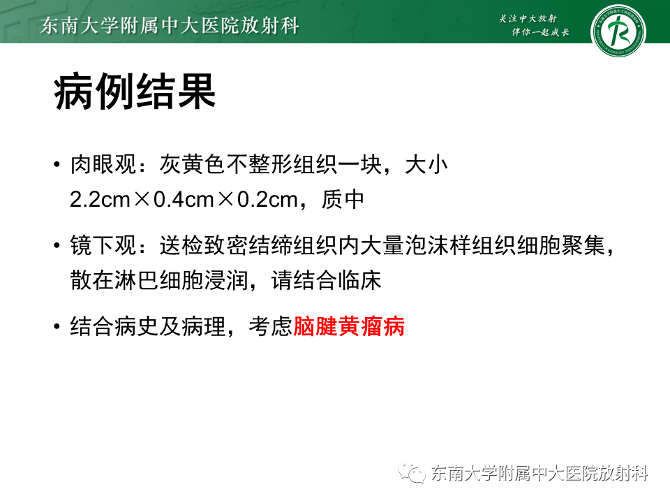 影像PPT - 【PPT】脑腱黄瘤病-4 影像PPT - 【PPT】脑腱黄瘤病-4