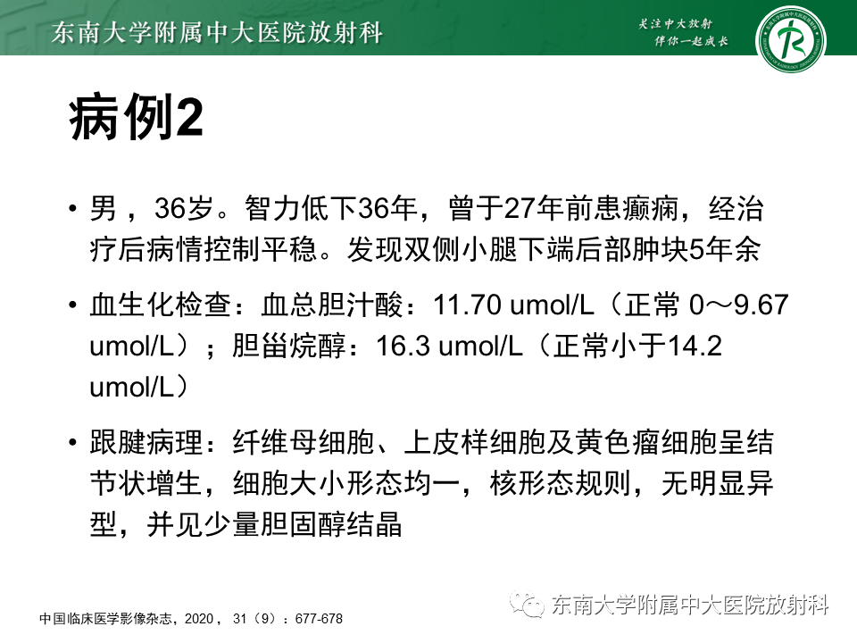 影像PPT - 【PPT】脑腱黄瘤病-16 影像PPT - 【PPT】脑腱黄瘤病-16