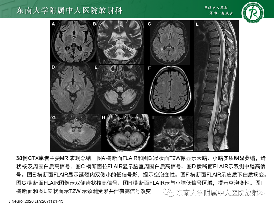 影像PPT - 【PPT】脑腱黄瘤病-15 影像PPT - 【PPT】脑腱黄瘤病-15