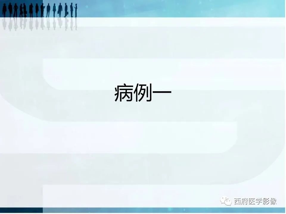 影像PPT - 【PPT】直背综合征影像诊断要点-2