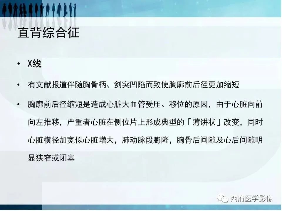影像PPT - 【PPT】直背综合征影像诊断要点-20