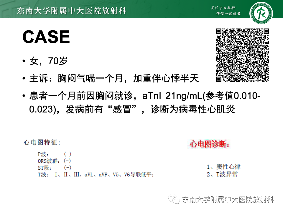 影像PPT - 【PPT】CMR在心肌梗死中的运用-12 影像PPT - 【PPT】CMR在心肌梗死中的运用-12