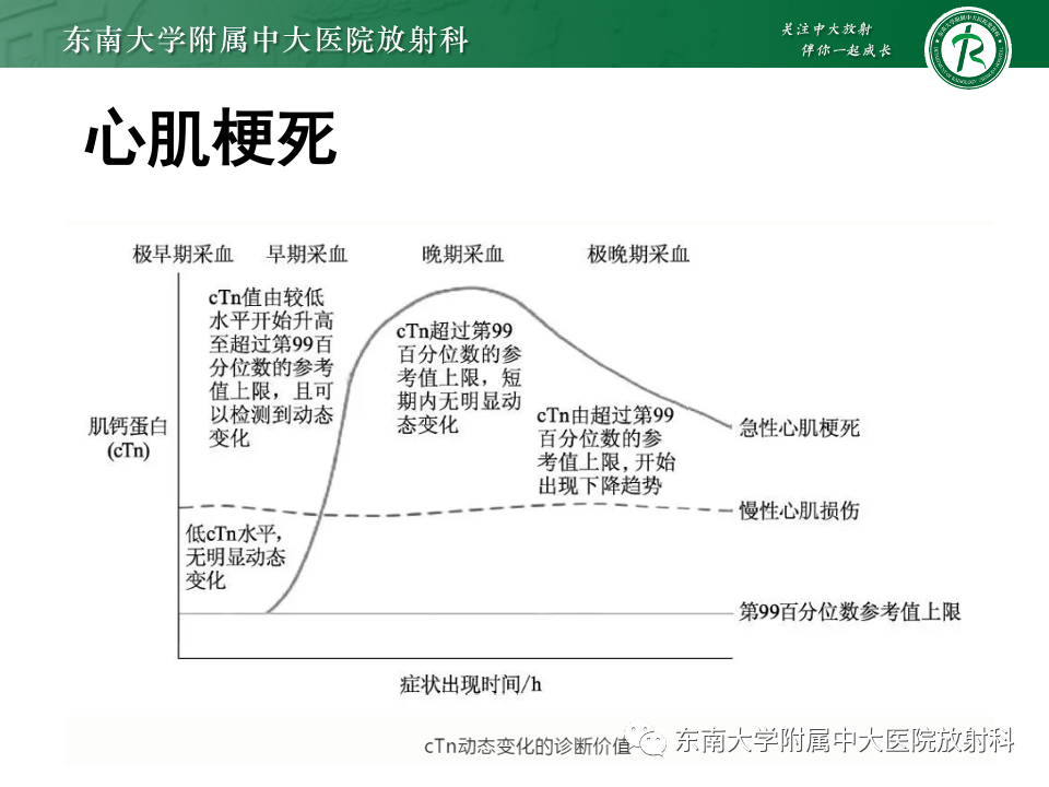 影像PPT - 【PPT】CMR在心肌梗死中的运用-22 影像PPT - 【PPT】CMR在心肌梗死中的运用-22