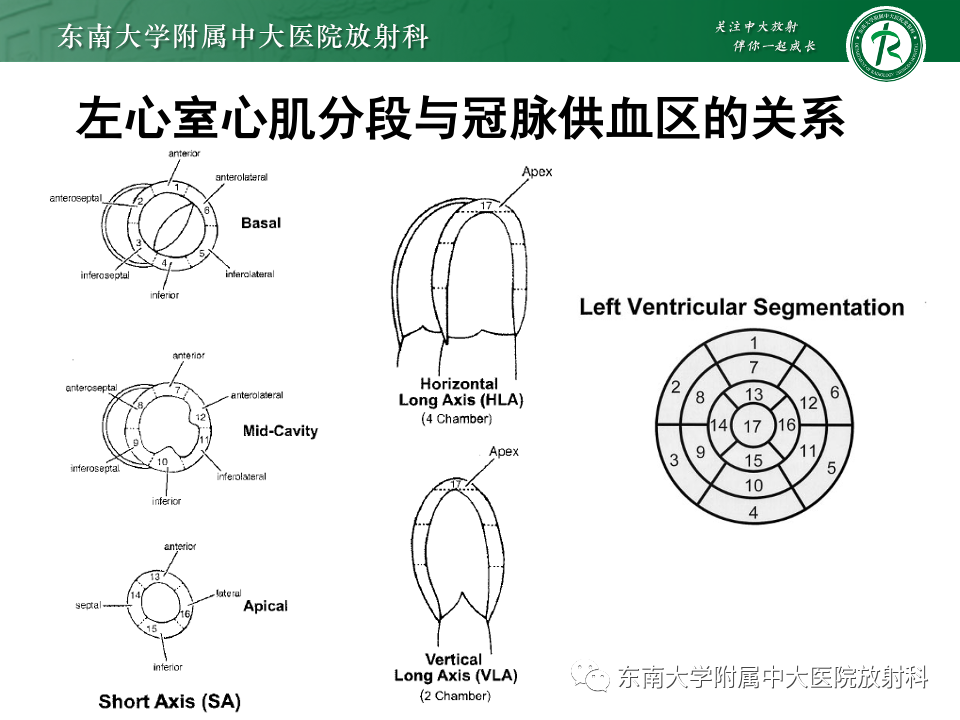 影像PPT - 【PPT】CMR在心肌梗死中的运用-27 影像PPT - 【PPT】CMR在心肌梗死中的运用-27