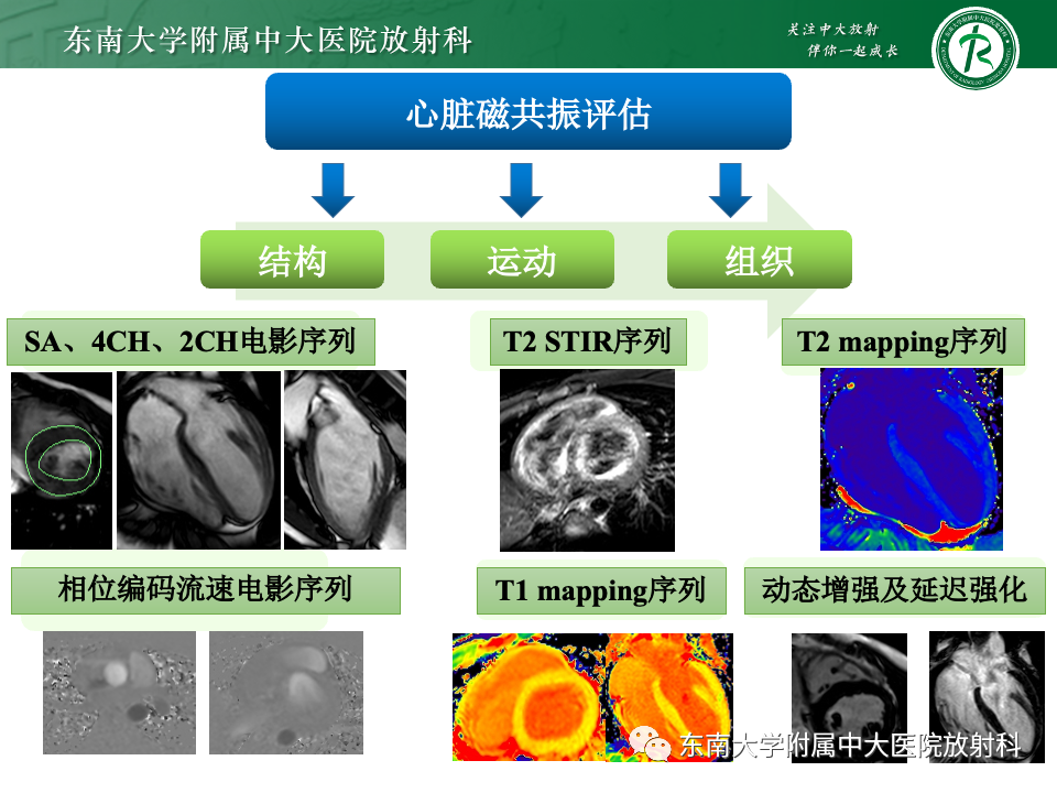 影像PPT - 【PPT】CMR在心肌梗死中的运用-26 影像PPT - 【PPT】CMR在心肌梗死中的运用-26