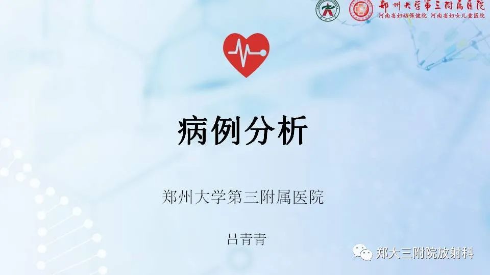 影像PPT - 【PPT】齿状突加冠综合征-1
