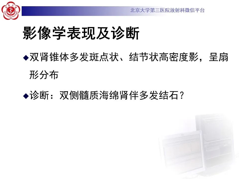 影像PPT - 【PPT】髓质海绵肾的影像-6