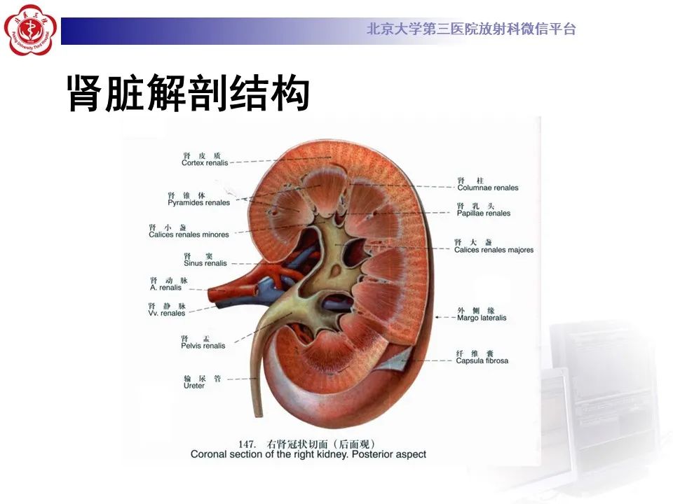 影像PPT - 【PPT】髓质海绵肾的影像-18