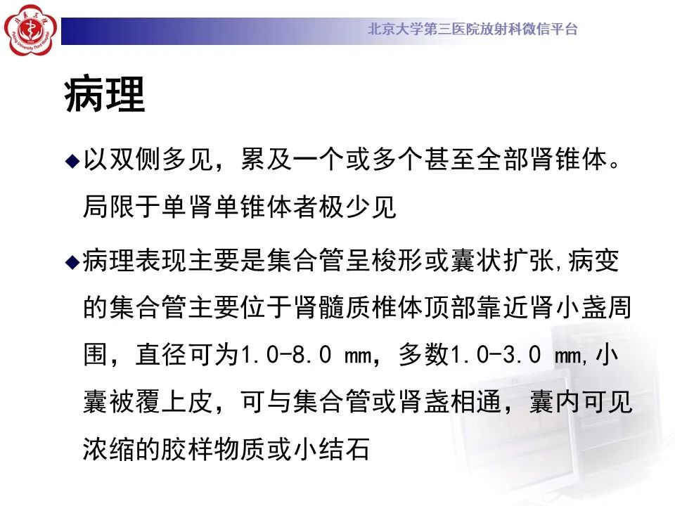 影像PPT - 【PPT】髓质海绵肾的影像-21