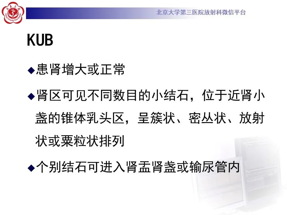 影像PPT - 【PPT】髓质海绵肾的影像-24