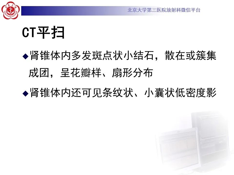 影像PPT - 【PPT】髓质海绵肾的影像-30