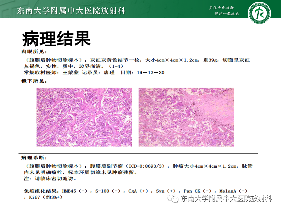影像PPT - 【PPT】副神经节瘤的影像-3