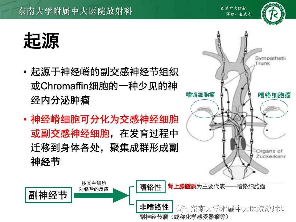 影像PPT - 【PPT】副神经节瘤的影像-7