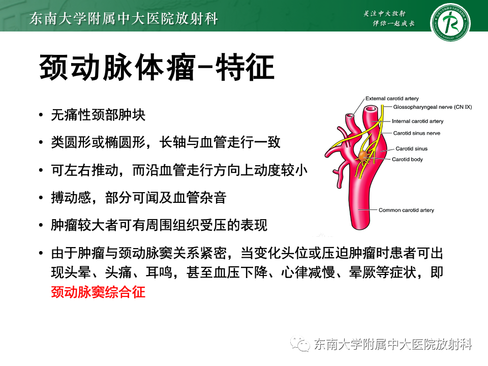 影像PPT - 【PPT】副神经节瘤的影像-19