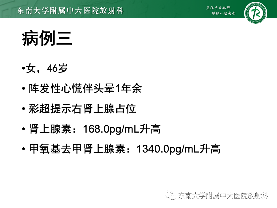 影像PPT - 【PPT】副神经节瘤的影像-36