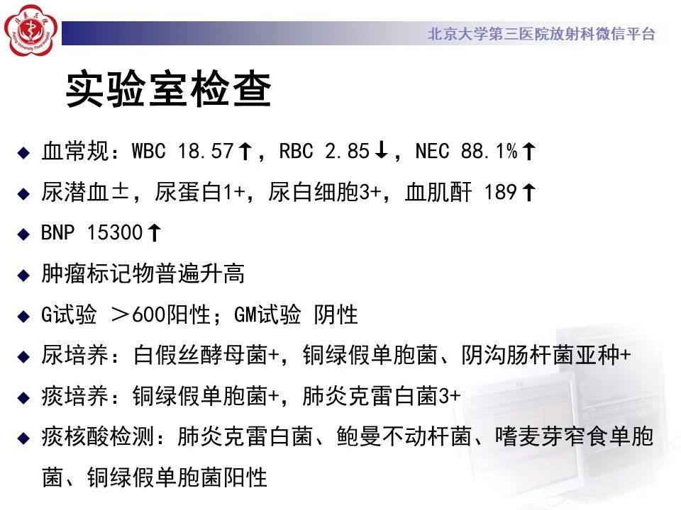 影像PPT - 【PPT】侵袭性念珠菌病肺内播散的影像-4